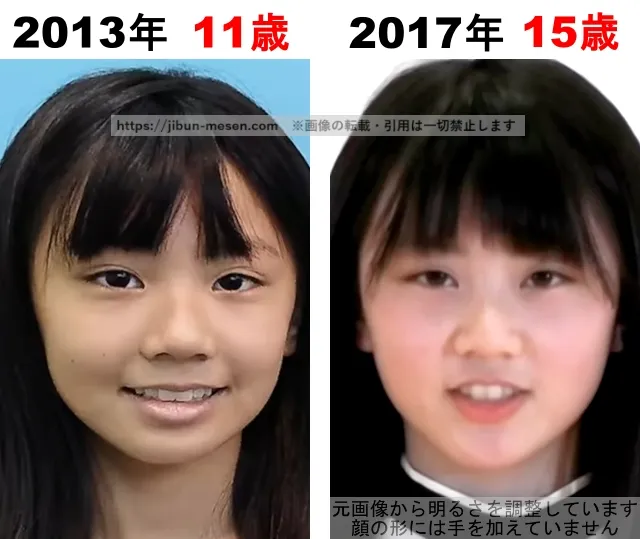 XGヒナタの整形検証2013年~2017年