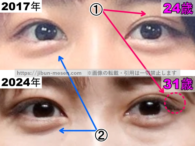 有村架純の目の整形検証2017年〜2024年（拡大）の画像