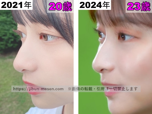 影山優佳の鼻の整形検証2021年～2024年（横顔）の画像