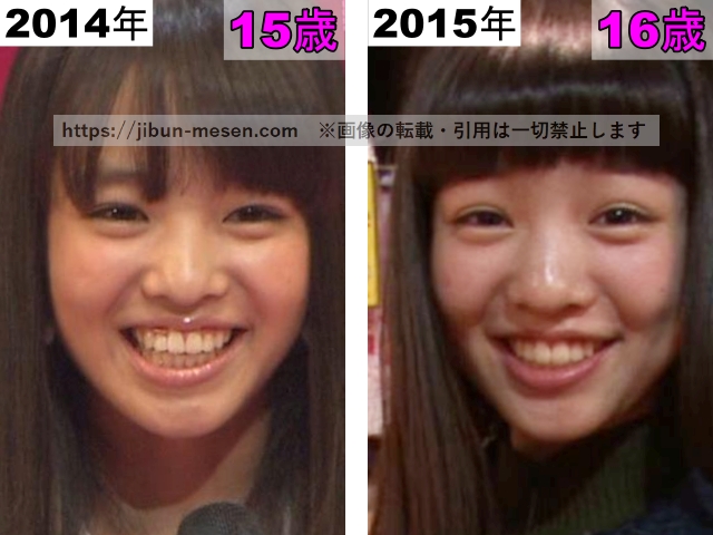 横田真悠の目の整形検証2014年～2015年の画像