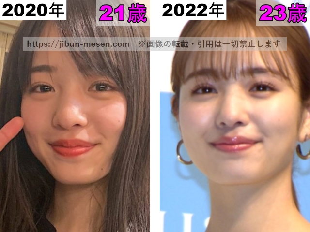 横田真悠のホクロの整形検証2020年～2022年の画像