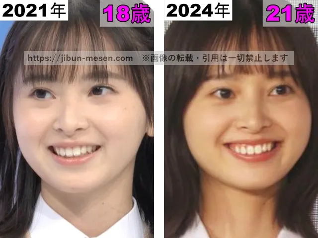 飯沼愛の鼻の整形検証2021年～2024年