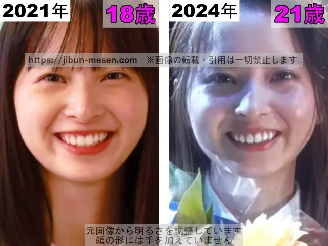 飯沼愛の唇の整形検証2021年～2024年