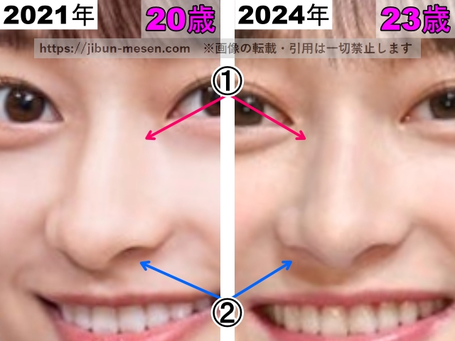 影山優佳の鼻の整形検証2021年～2024年（拡大）の画像
