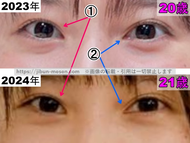 飯沼愛の目の整形検証2023年～2024年（拡大）の画像