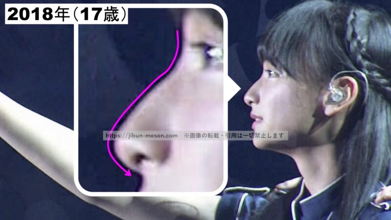 影山優佳の鼻筋の画像