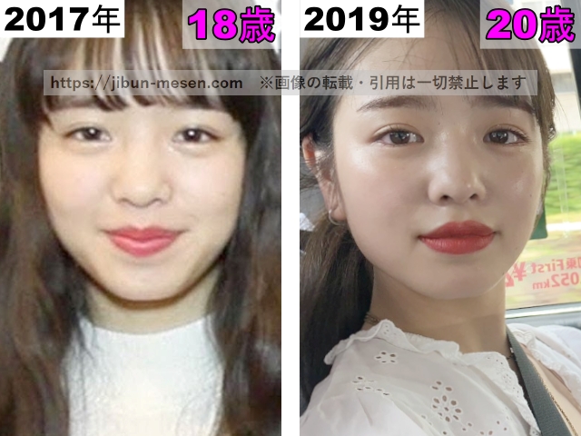 横田真悠の目の整形検証2017年～2019年の画像