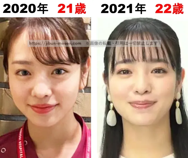 横田真悠の整形検証2020年~2021年
