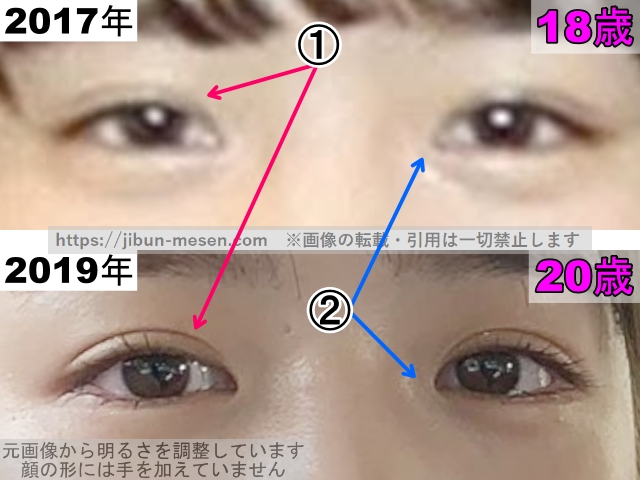 横田真悠の目の整形検証2017年～2019年（拡大）の画像