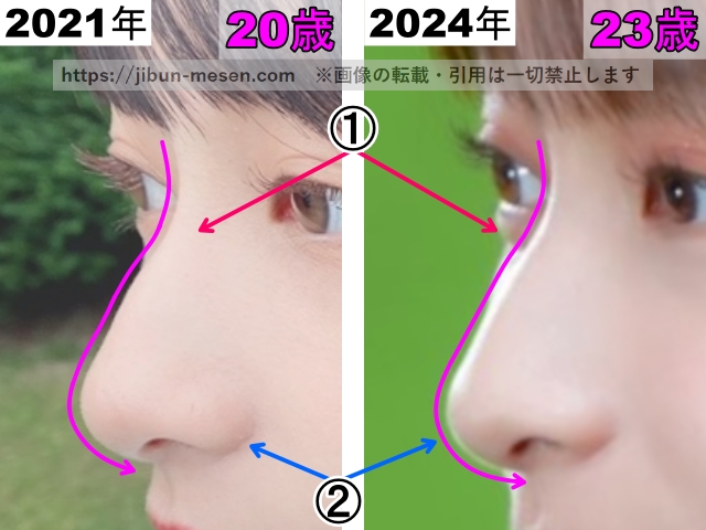 影山優佳の鼻の整形検証2021年～2024年（横顔・拡大）の画像