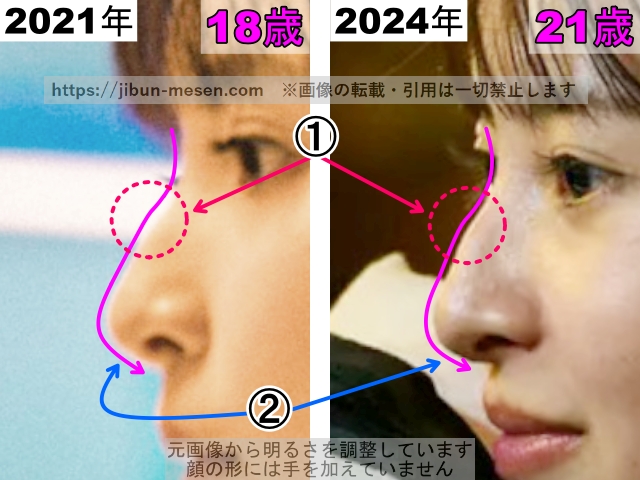 飯沼愛の鼻の整形検証2021年～2024年（横顔・拡大）の画像