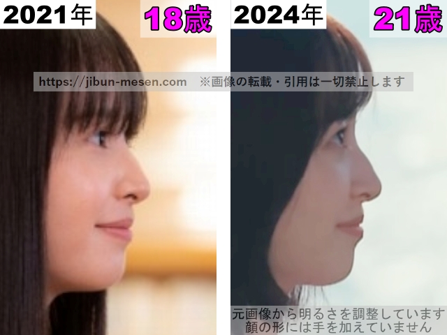 飯沼愛の唇の整形検証2021年～2024年（横顔）の画像