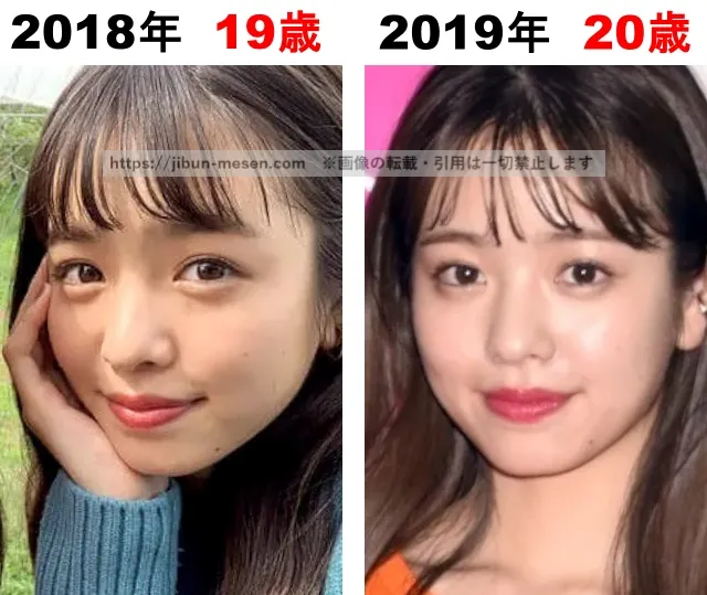 横田真悠の整形検証2018年~2019年