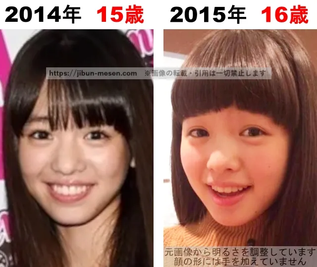 横田真悠の整形検証2014年~2015年