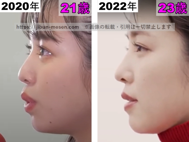 横田真悠の鼻の整形検証2020年～2022年（横顔）の画像