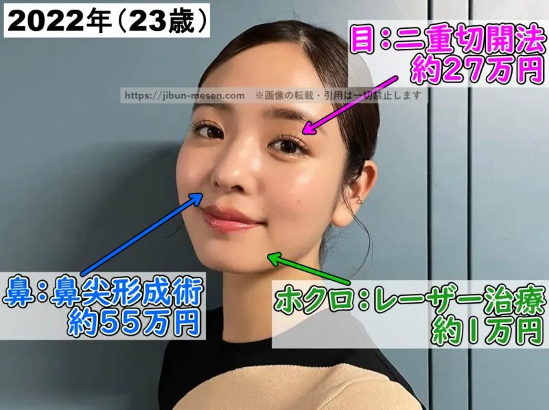 横田真悠が整形した箇所とその費用