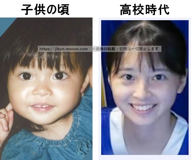 飯沼愛の整形検証子供の頃~高校時代