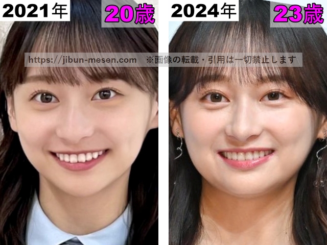 影山優佳の唇の整形検証2021年～2024年の画像