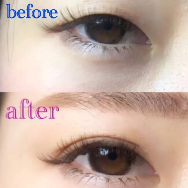 アイテープのビフォーアフター（ボーテHPより引用）の画像