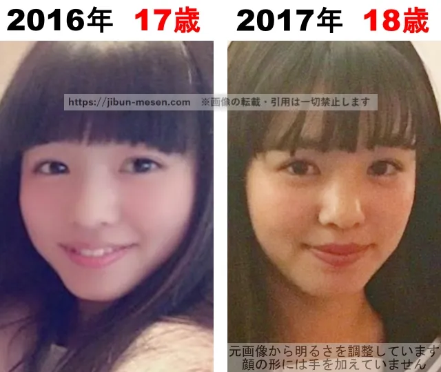 横田真悠の整形検証2016年~2017年