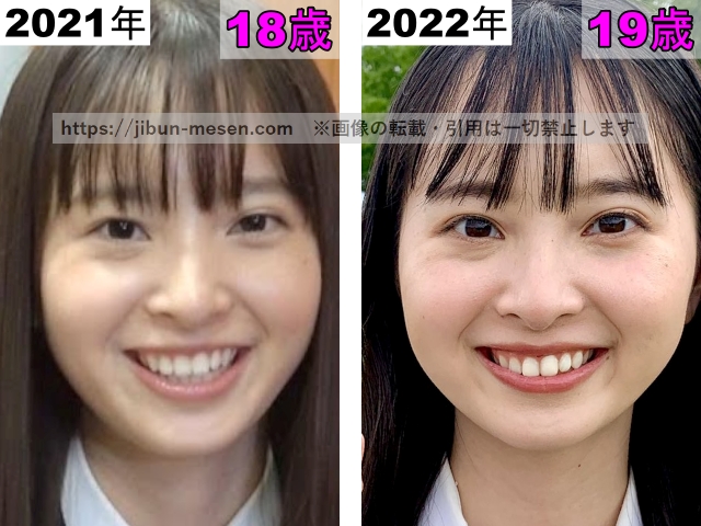 飯沼愛の目の整形検証2021年～2022年の画像