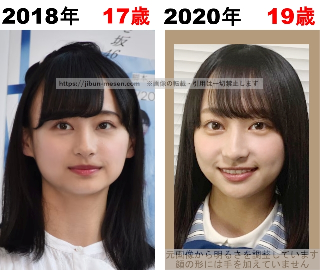 影山優佳の整形検証2018年～2020年