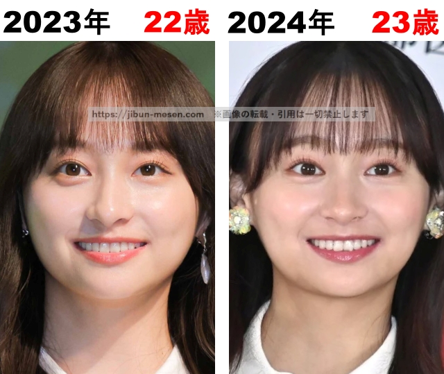 影山優佳の整形検証2023年～2024年