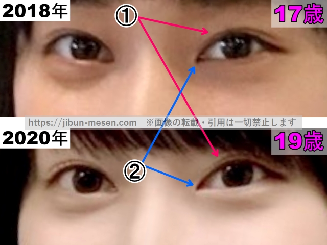 影山優佳の目の整形検証2018年～2020年（拡大）の画像