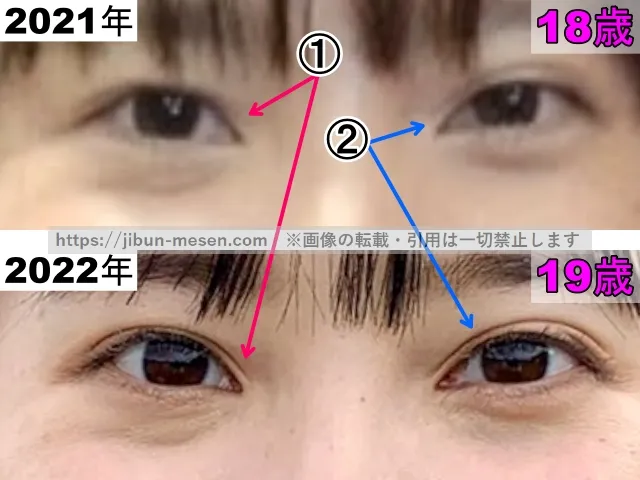 飯沼愛の目の整形検証2021年～2022年（拡大）