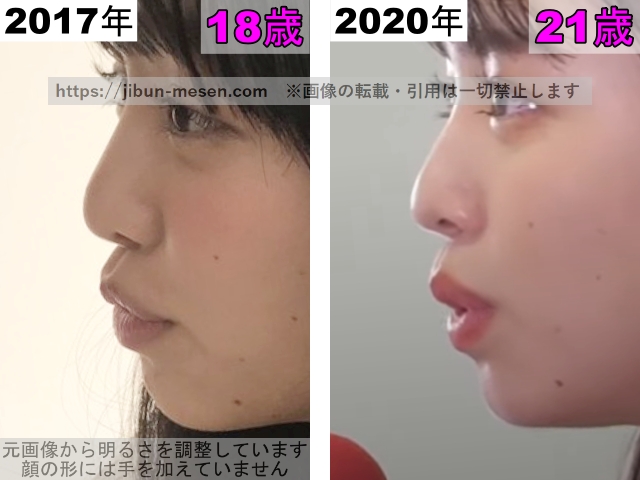 横田真悠の唇の整形検証2017年～2020年の画像