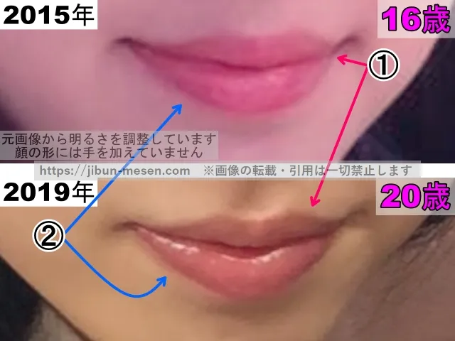 横田真悠の唇の整形検証2015年～2019年（拡大）