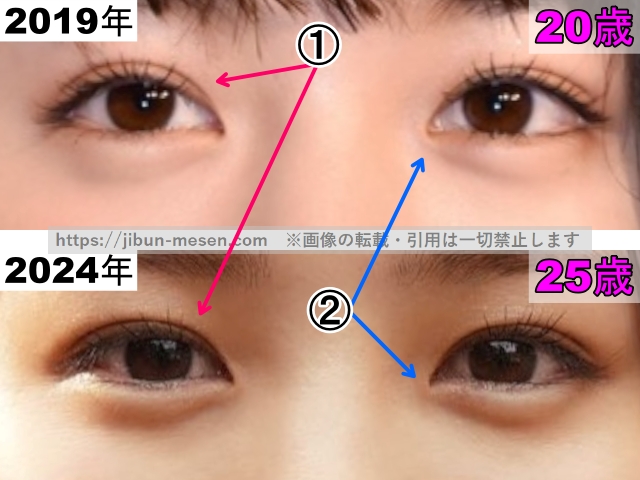 横田真悠の目の整形検証2019年～2024年（拡大）の画像