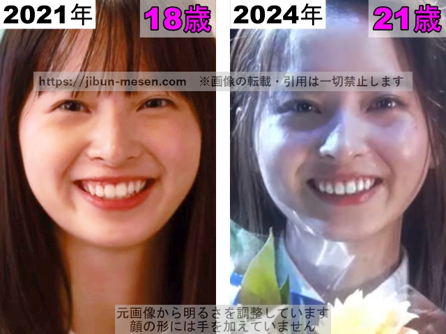 飯沼愛の唇の整形検証2021年～2024年の画像