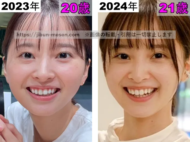 飯沼愛の目の整形検証2023年～2024年