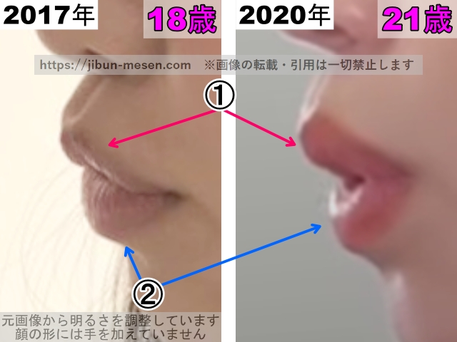 横田真悠の唇の整形検証2017年～2020年（拡大）の画像