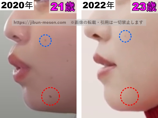 横田真悠のホクロの整形検証2020年～2022年（横顔・拡大）の画像