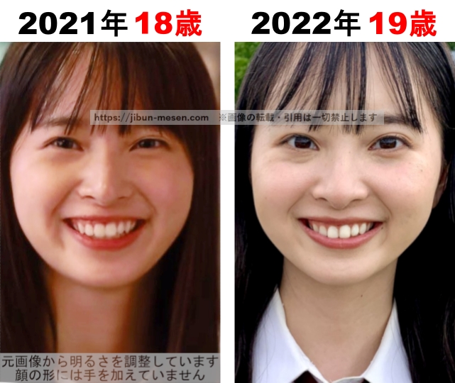 飯沼愛の整形検証2021年~2022年