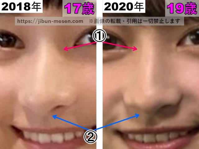 影山優佳の鼻の整形検証2018年～2020年（拡大）の画像