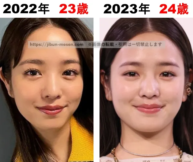 横田真悠の整形検証2022年~2023年