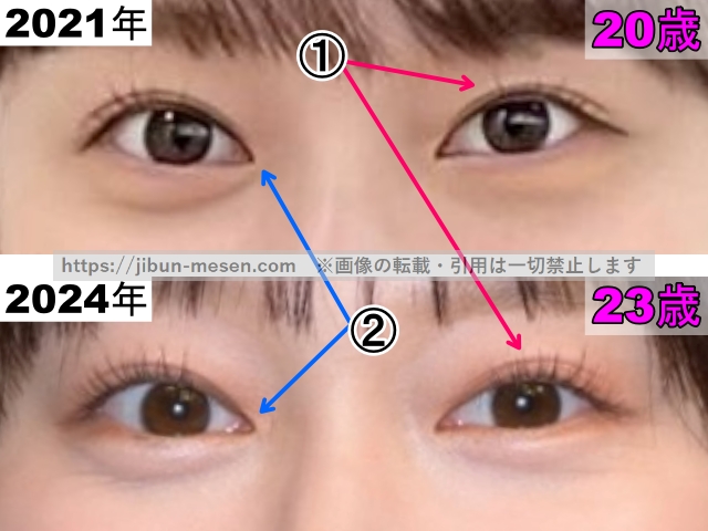 影山優佳の目の整形検証2021年～2024年（拡大）の画像