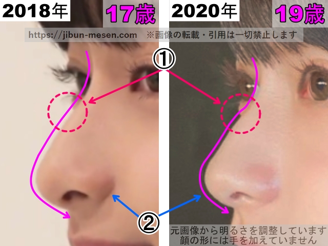 影山優佳の鼻の整形検証2018年～2020年（横顔・拡大）の画像