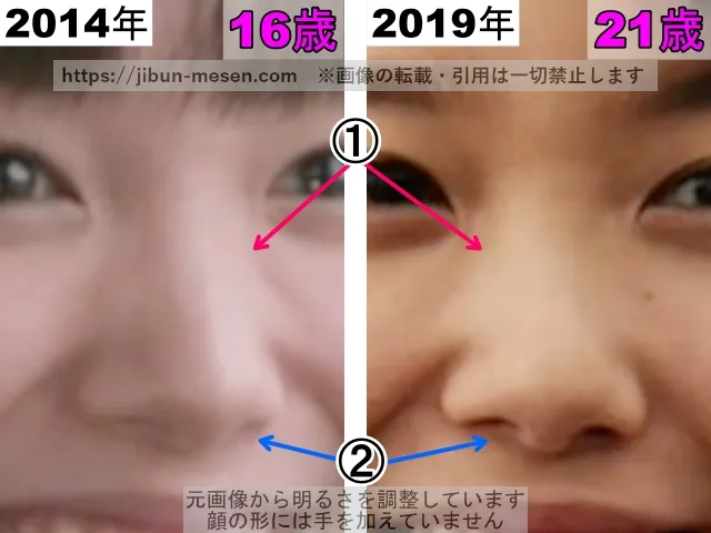 飯豊まりえの鼻の整形検証2014年~2019年(拡大)