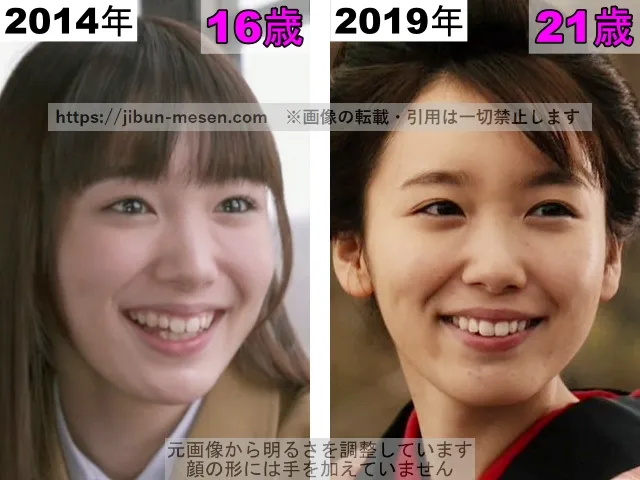 飯豊まりえの鼻の整形検証2014年~2019年