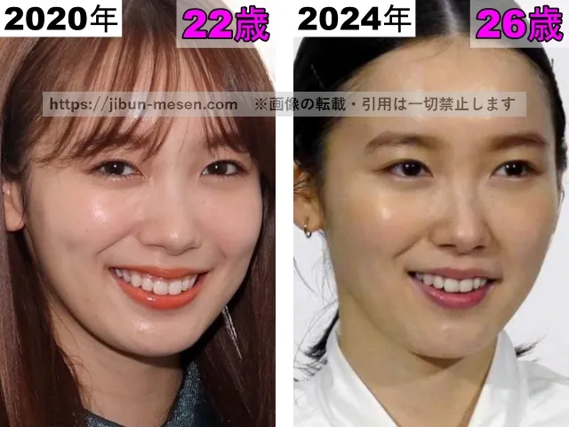 飯豊まりえの鼻の整形検証2020年~2024年