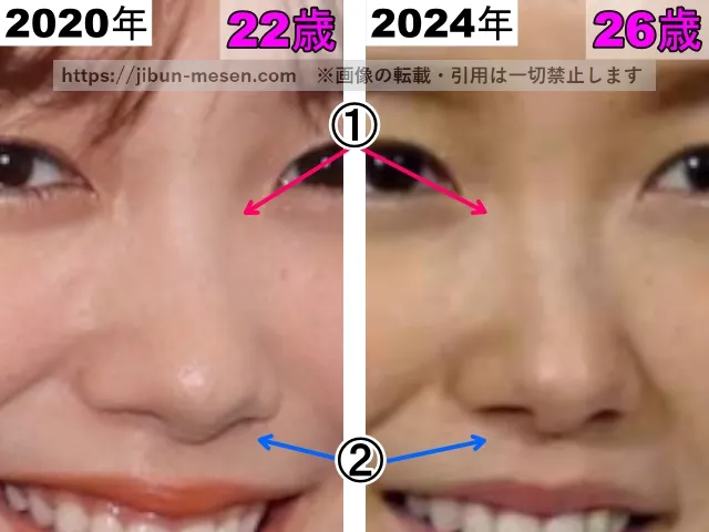 飯豊まりえの鼻の整形検証2020年~2024年(拡大)