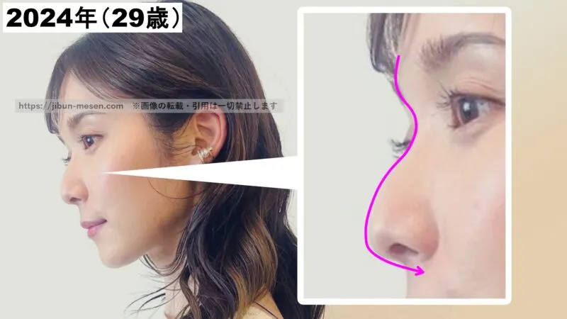 松岡茉優の眉間