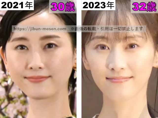 松井玲奈の目の整形検証2021年～2023年
