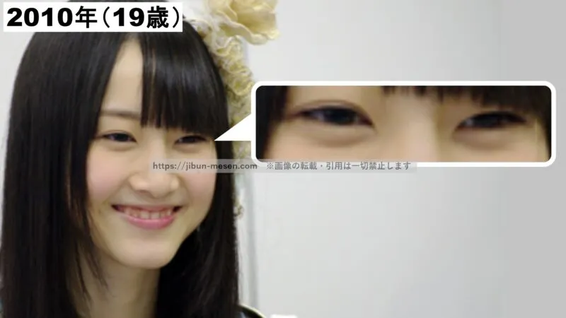 松井玲奈の二重まぶた