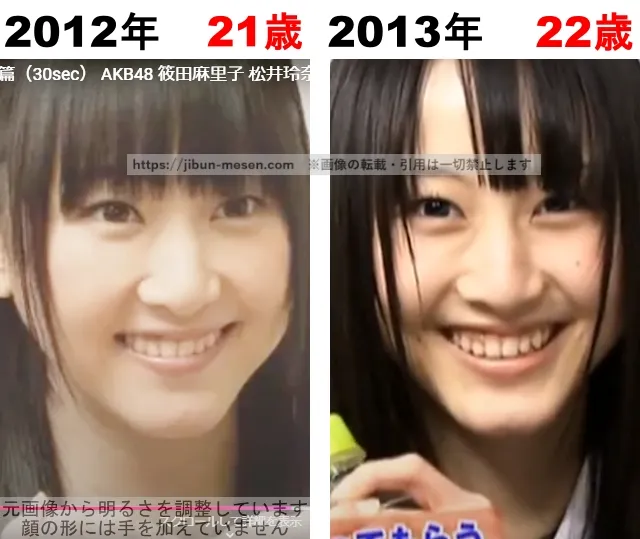 松井玲奈の整形検証2012年~2013年