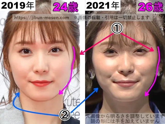 松岡茉優の顔の整形検証2019年～2021年（拡大）